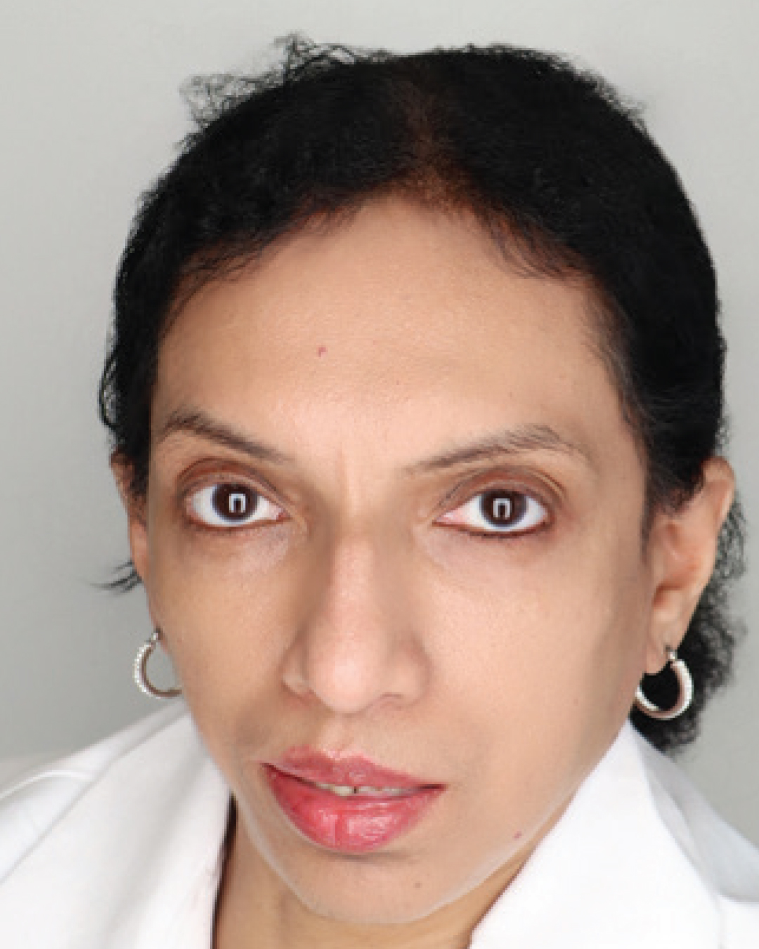Kala Shankar, M.D.